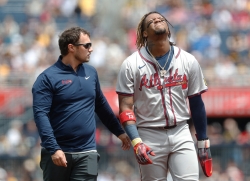 Ronald Acuña Jr out for season with ACL tear in crushing Braves injury blow